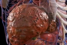 Medicina Neconventionala Alternativa Iasi Biorezonanta Medicina Alternativa Iasi - BioPlantPharma